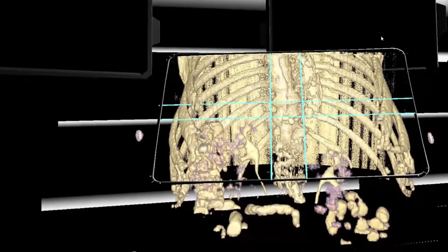 Amplifier AI — MRI visualization in VR